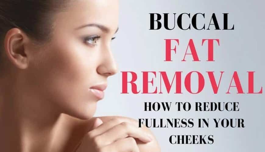 Buccal Fat Removal Surgery