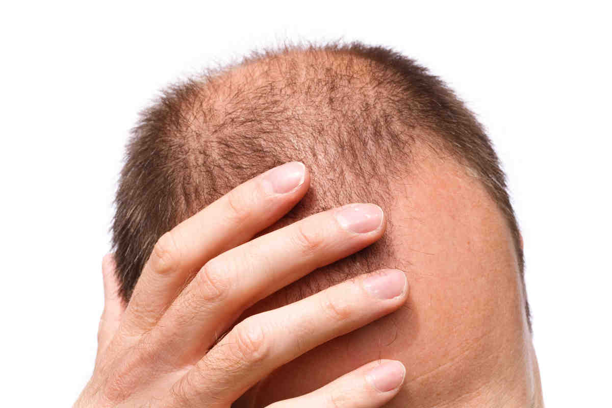 Man expressing stress, worry or depression; isolated against a white background/ Don't Confuse & Complication of Hair Transplant Surgery - FUE & FUT