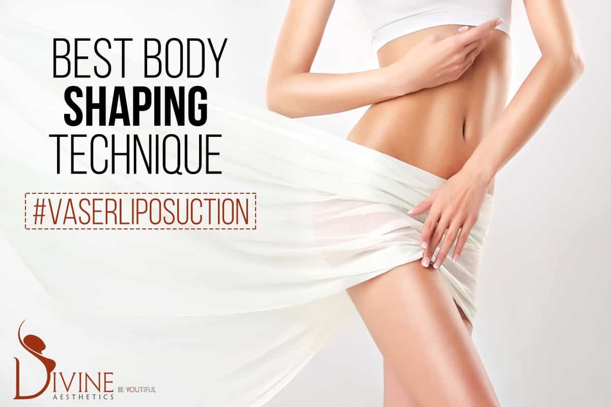 VASER Liposuction