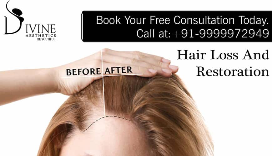 How Can Plastic Surgeons Treat Hair Loss and Restoration