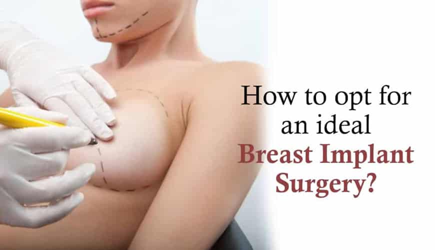 HOW TO OPT FOR AN IDEAL BREAST IMPLANT SURGERY?