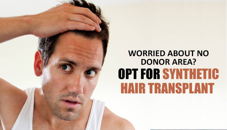 Worried About No Donor Area Opt For Synthetic Hair Transplant