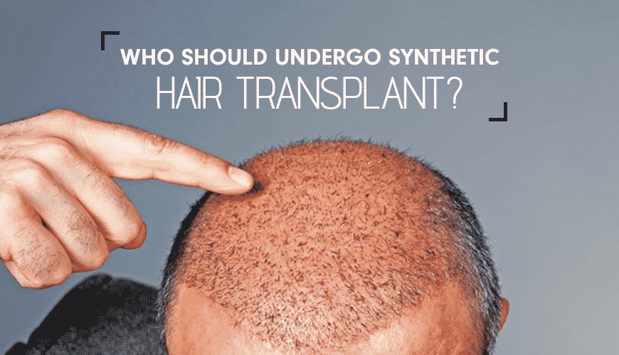 Synthetic Hair Transplant