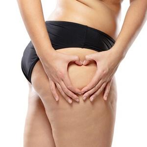 vaser liposuction minimizes damage to the vessels reducing blood loss.