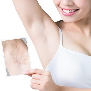 Laser hair-removal-underarms