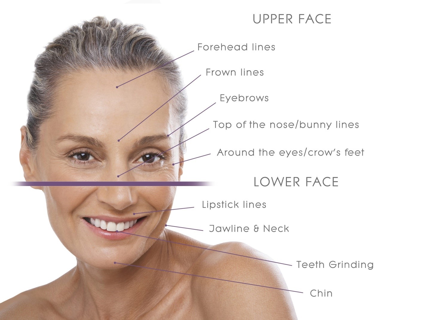 where botox treatment can be used