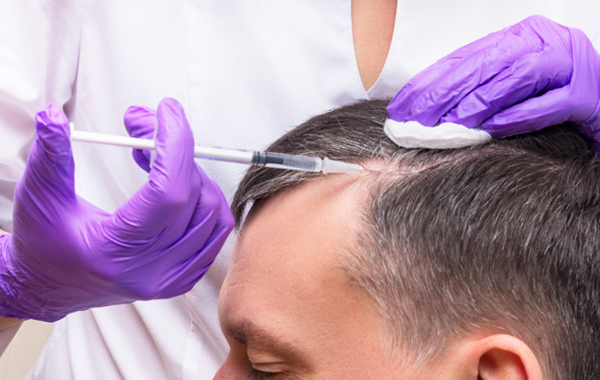 Cost of Hair PRP Treatment