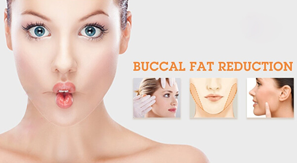 Recovery After Buccal Fat Surgery