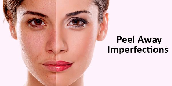Cost of Chemical Peels
