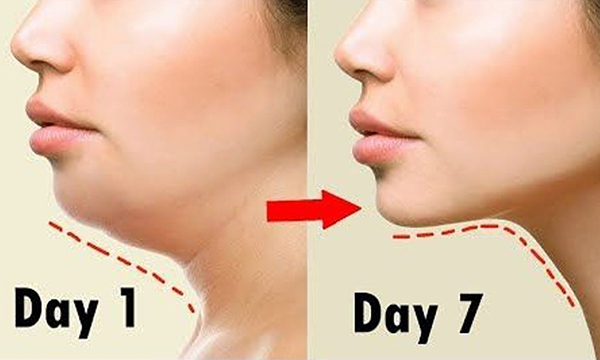 The-risk-involved-in-Double-Chin-Removal-contact-dr.-Amit-agupta