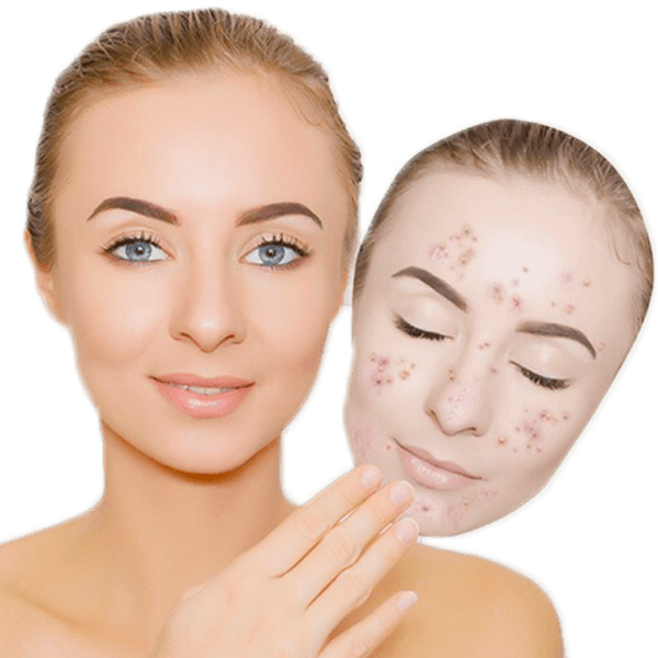 micro needling treatment to rejuvenate your looks(1)