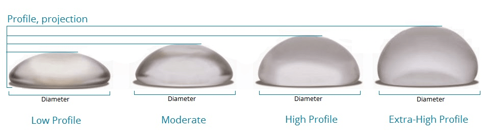type of implant according to projection
