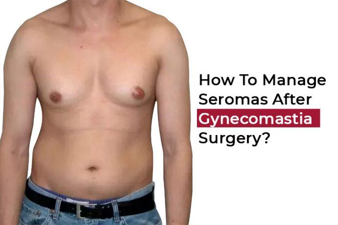 How to Manage Seromas after gynecomastia surgery