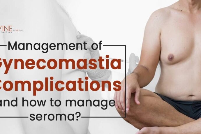 Management of complications and how to manage seroma