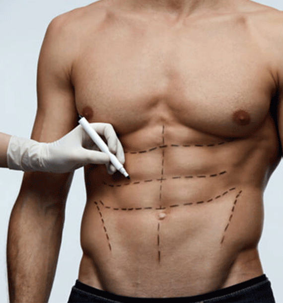 The-risk-involved-in-Six-Pack-Abs-Surgery