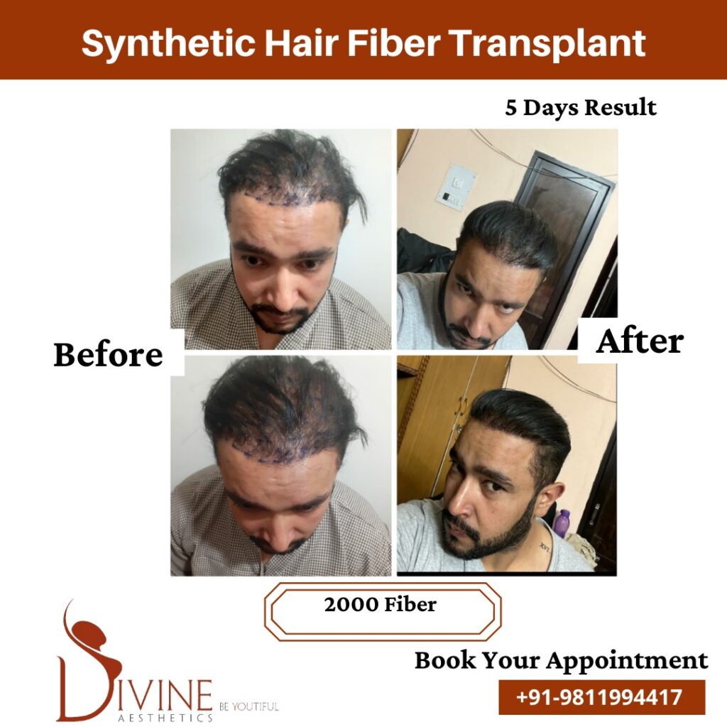 Are you  Satya Skin Laser  Hair Transplant Clinic  Facebook