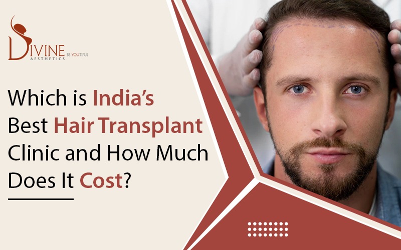 Which is India’s Best Hair Transplant Clinic and How Much Does It Cost for Hair Transplant?