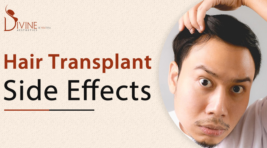 Know the Side Effects of Hair Transplant Surgery