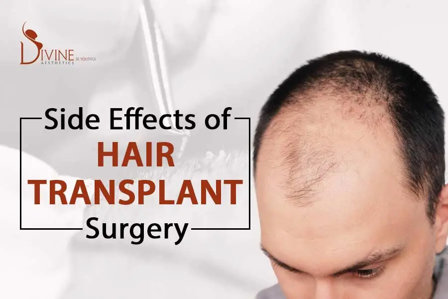 side effects of hair transplant surgery