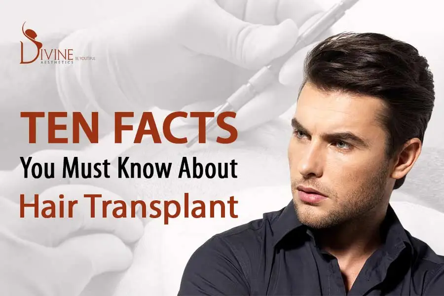 facts of hair transplant surgery