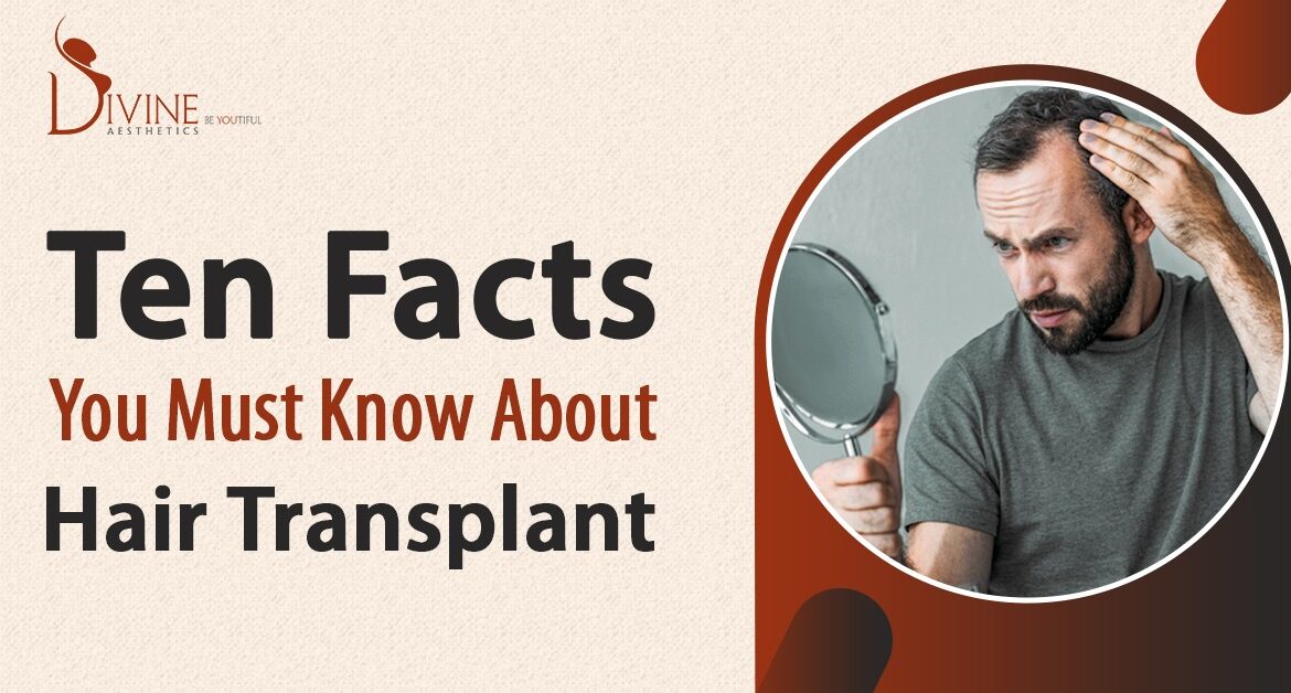 Ten Facts You Must Know about Hair Transplant