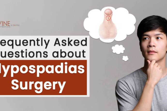 FAQs on Hypospadias Surgery