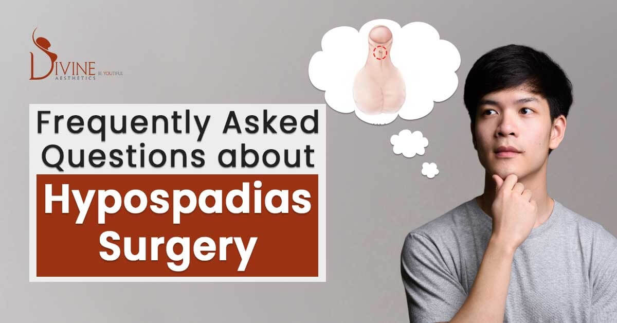About Hypospadias Surgery Frequently Asked Questions