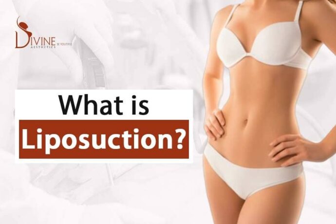 Vaser liposuction in Delhi