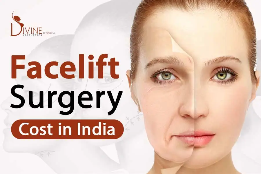 facelift surgery cost in india