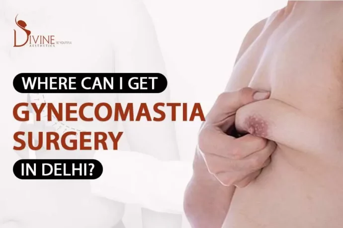 Male Breast Reduction Surgery in Delhi , Gynecomastia