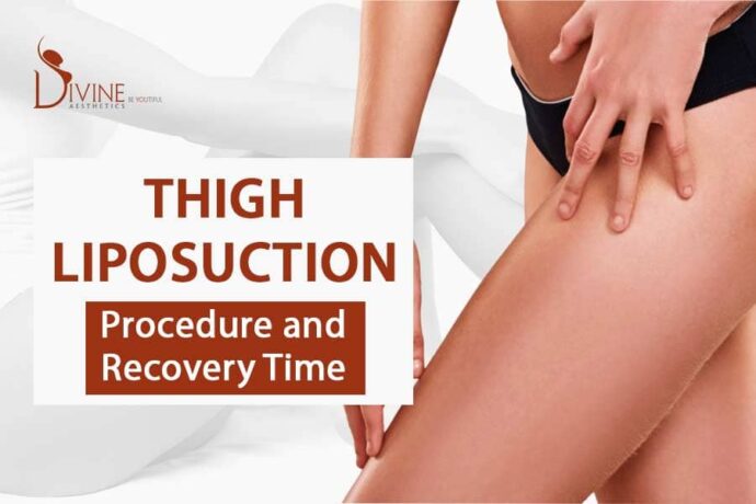 Thigh liposuction recovery time