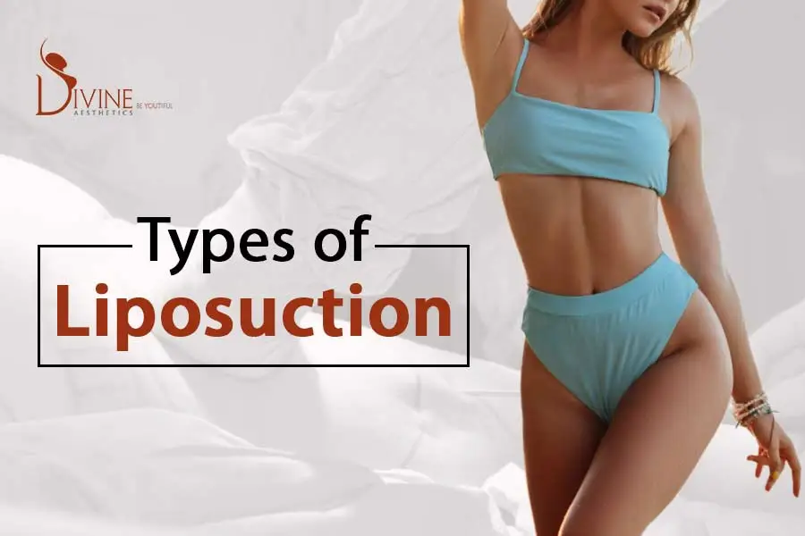 Types of Liposuction , liposuction in delhi