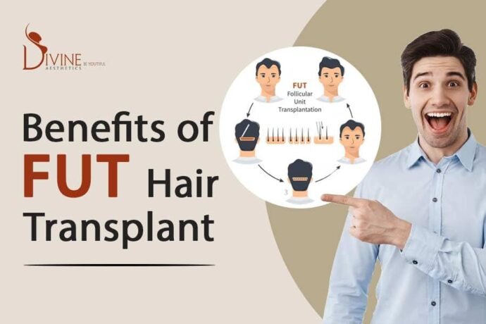 Benefits of FUT Hair Transplant