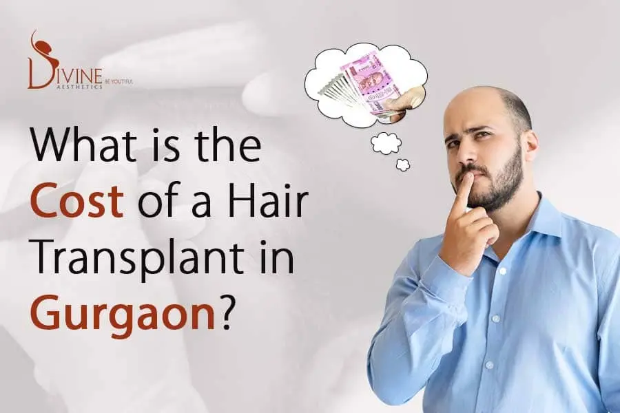 Cost of a hair transplant in Gurgaon