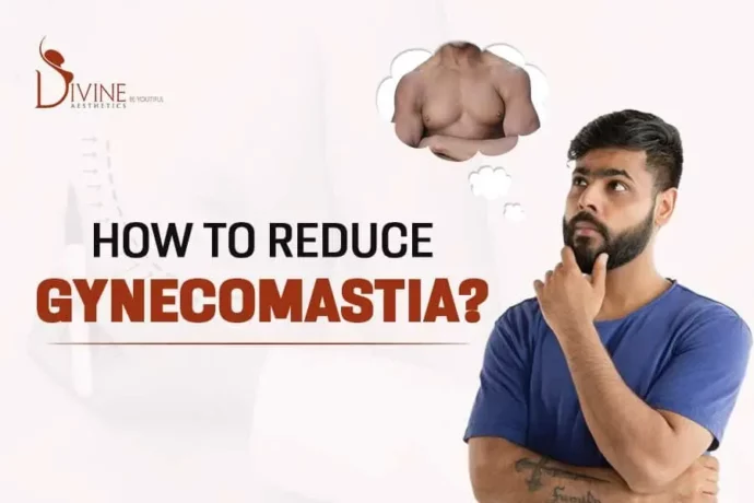 Gynecomastia Treatment Without Surgery