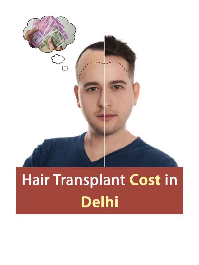 Factors of Hair transplant cost in Delhi