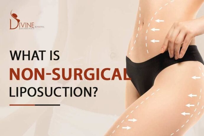 Non surgical Liposuction