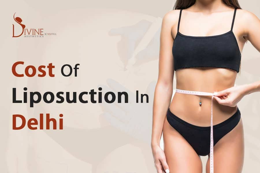 What Is the Cost of Liposuction in Delhi , India and Factors of Price