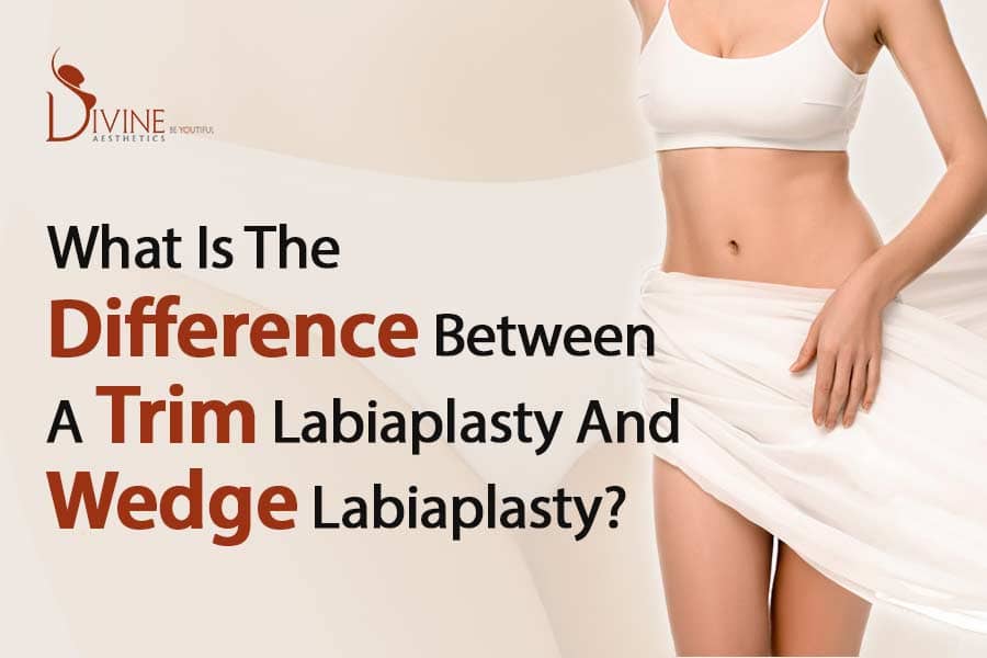 What is the Difference Between a Trim Labiaplasty and Wedge Labiaplasty?