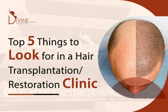 best clinic for hair transplant