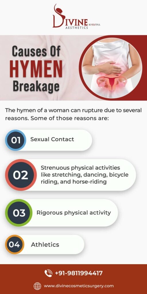 Cost of Hymenoplasty Surgery in Delhi - Causes of Hymen Breakage