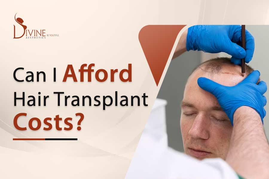 Can I Afford Hair Transplant Cost?
