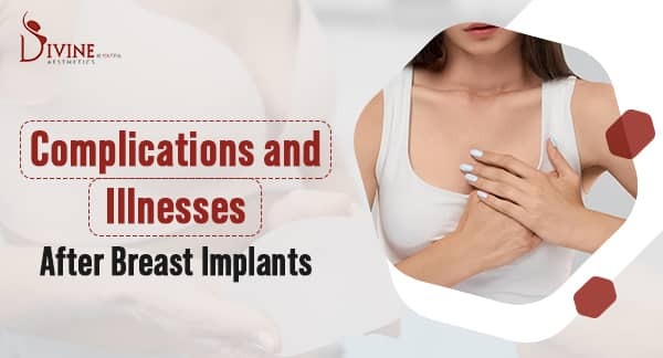 Breast Complications and Illnesses After Breast Implants
