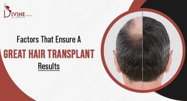 Factors That Ensure a Great Hair Transplant Results