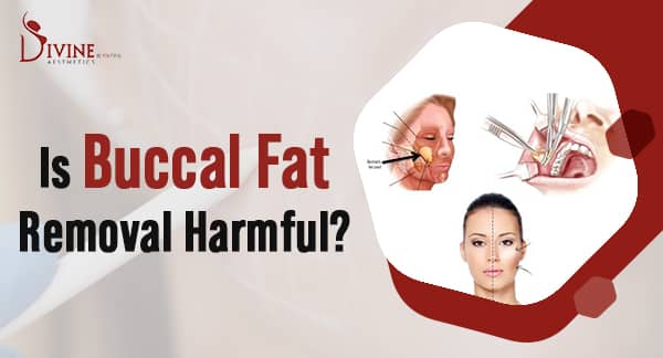 Is Buccal Fat Removal Harmful? Face Fat Removal