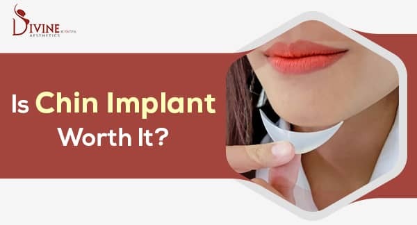 Chin Implant Surgery - Pros And Cons and Recovery