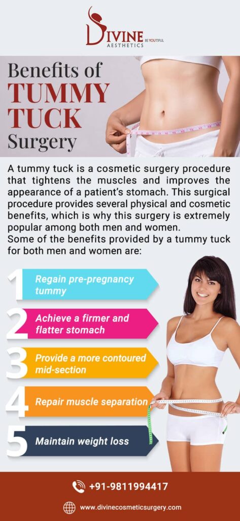 Benefits of Tummy Tuck Surgery