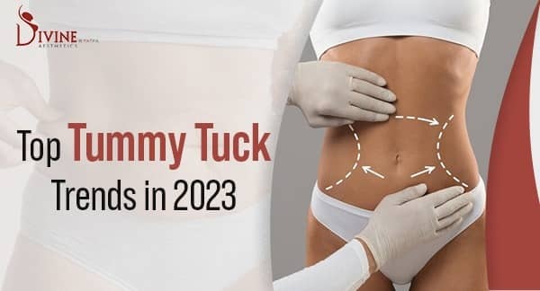 Top Tummy Tuck Trends in 2023