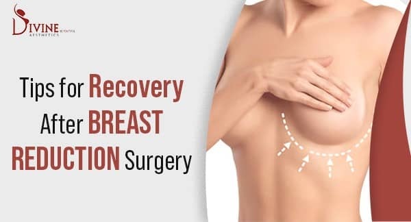 After Breast Reduction Surgery Recovery and Tips