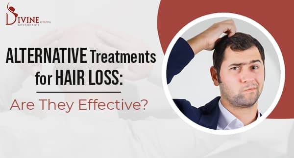 Alternative Treatments for Hair Loss Are They Effective